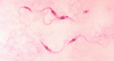 Kissing Bug Chagas Disease Pest Prevention; Bite Marks, Symptoms, Diagnosis & Treatment